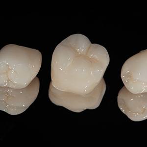 an assortment of dental crowns against a black background